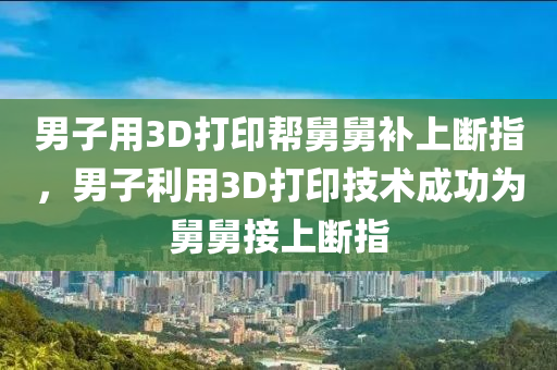 男子用3D打印帮舅舅补上断指，男子利用3D打印技术成功为舅舅接上断指